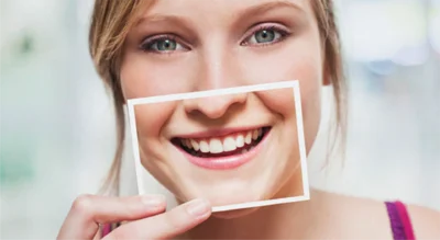 Well Leite - Clareamento Dental.