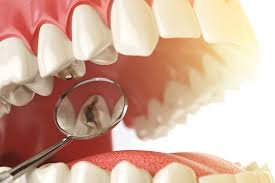 Well Leite Odontologia - Restauração Dentária.